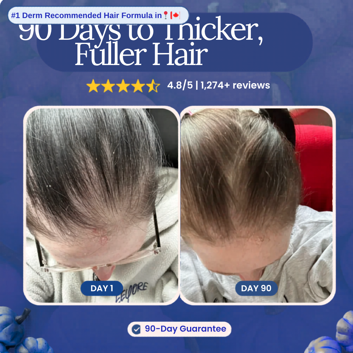Less Shedding in 25 Days or Less