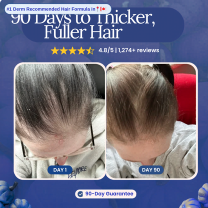 Less Shedding in 25 Days or Less