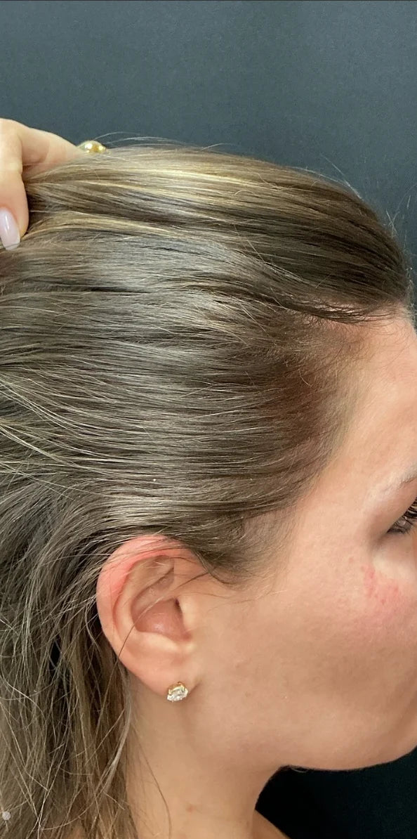 Clare D. - Month 3