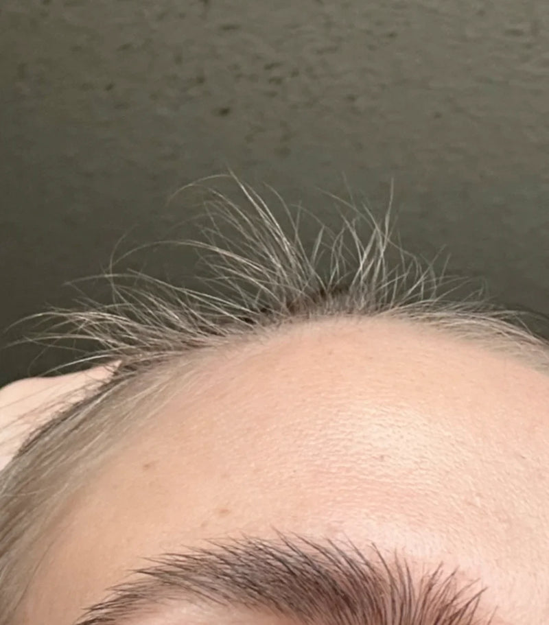 Baby Hairs & Initial Regrowth