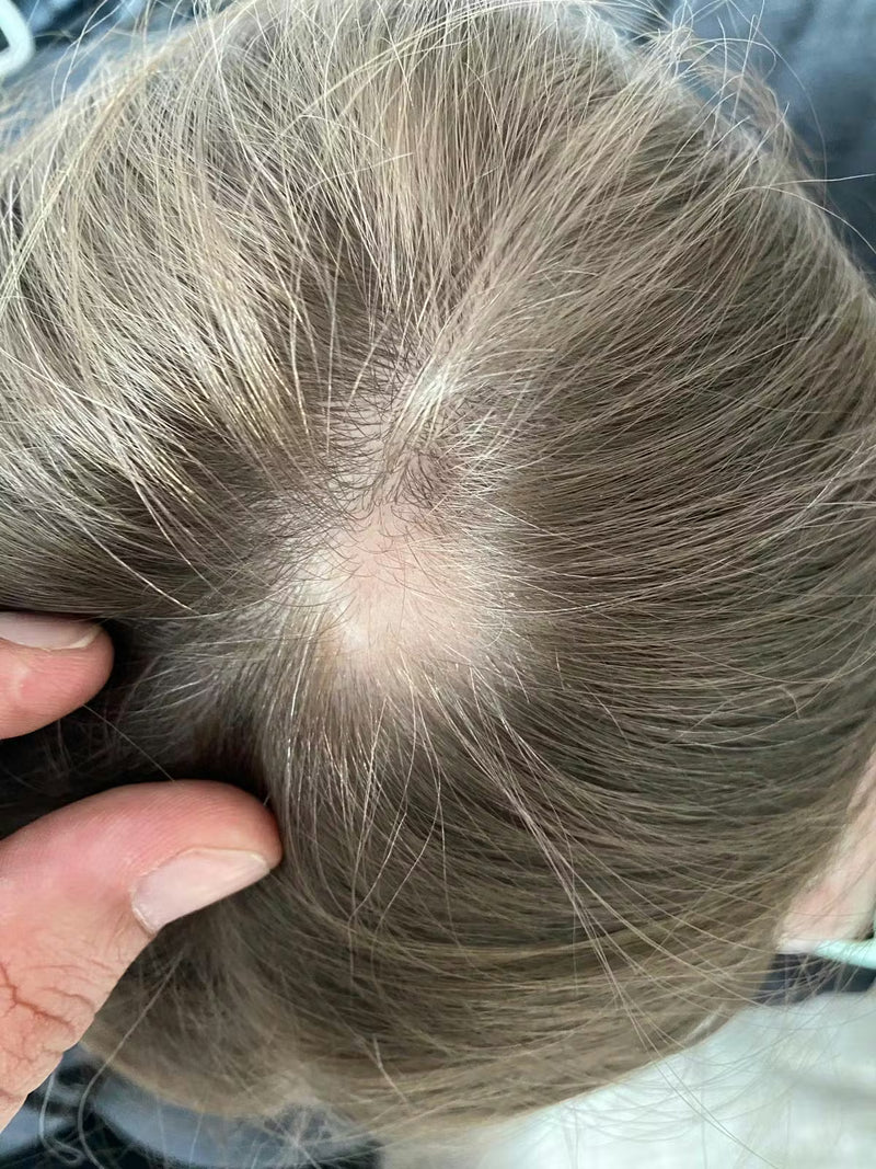 Healthier Scalp & Reduced Shedding